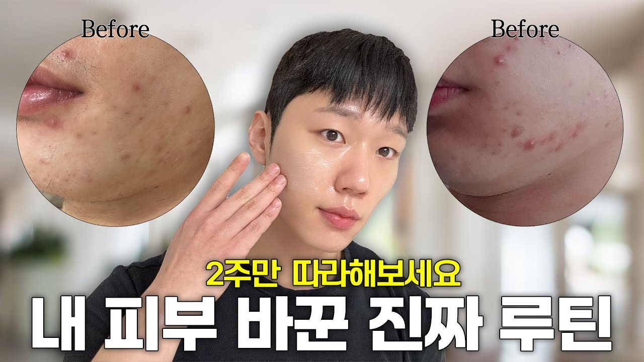 따라하면 좋아질 수 밖에 없는 뒤집힌 피부 회복 루틴 - Jun_dol 썸네일