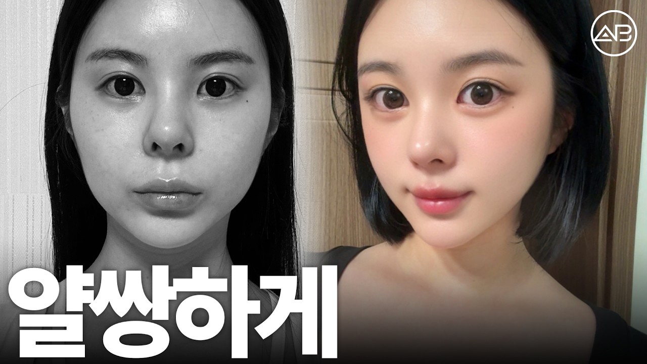 필러 맞던 턱끝도 윤곽수술로 해결하니 편해요 | 후기있음 | 에이비성형외과 - abplasticsurgery 썸네일