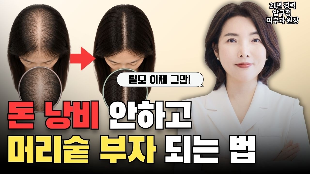 탈모! 포기하지 마세요. 돈 안들이고 모발 풍성해지세요. - 황박사티비 썸네일